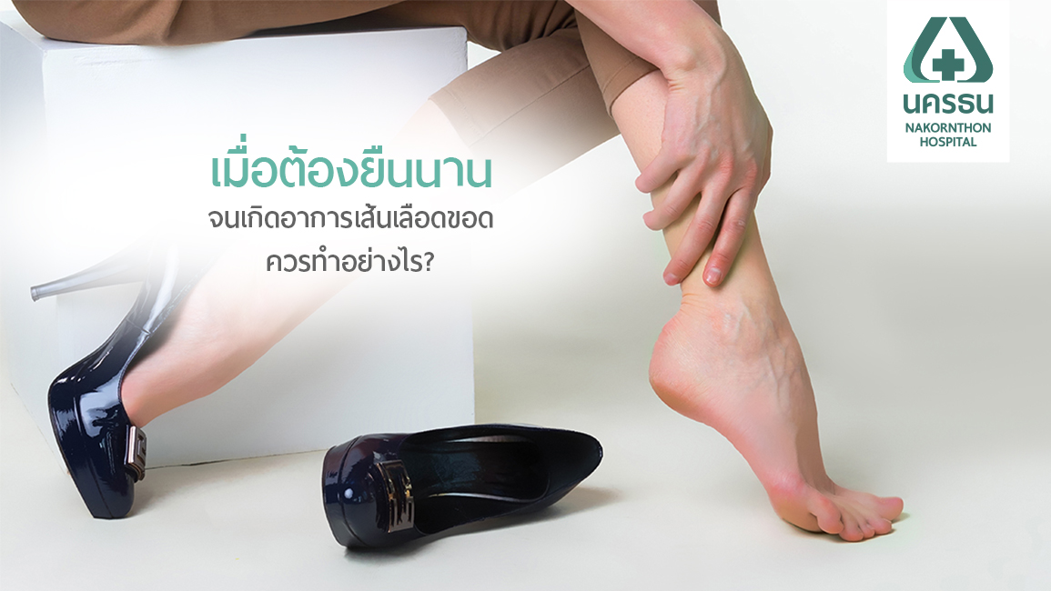 รู้ทัน รักษาไว ปลอดภัยจาก “เส้นเลือดขอด”